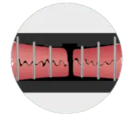 Carga U-Lock e Hybrid - Scitech