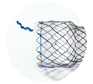 EPE - Parcial coberto - Hanaro Stent