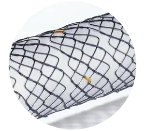 EPE - Parcial coberto - Hanaro Stent