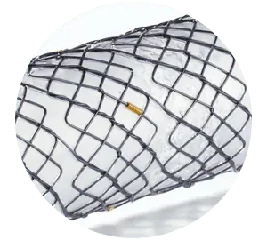 EPF - Parcial coberto com válvula - Hanaro Stent