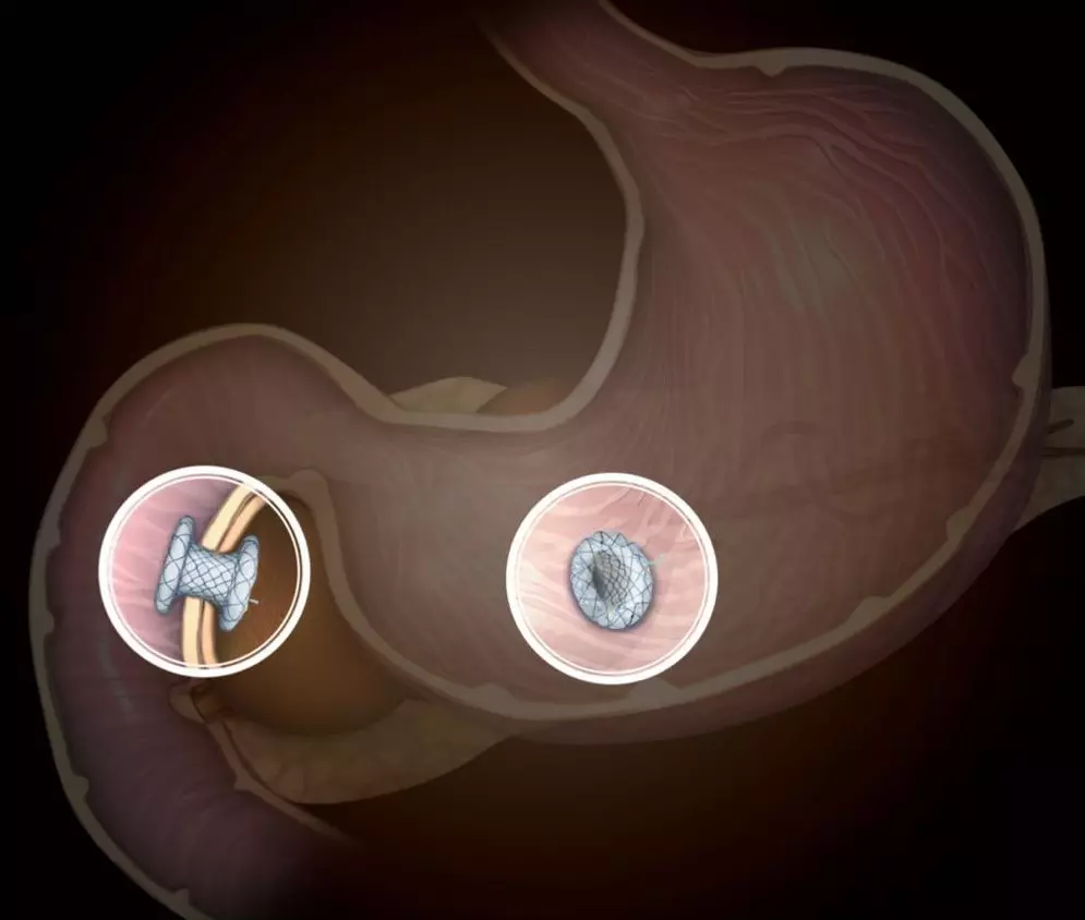 BCF – Total coberto plumber