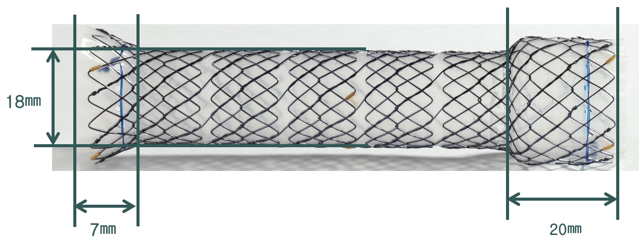 NESC – Total coberto cervical - Hanaro Stent