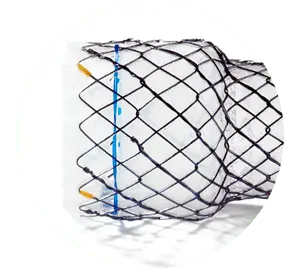 NESC – Total coberto cervical - Hanaro Stent