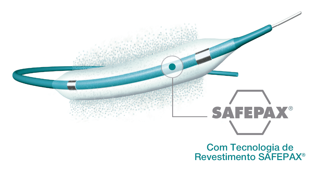 APERTO® OTW - Scitech