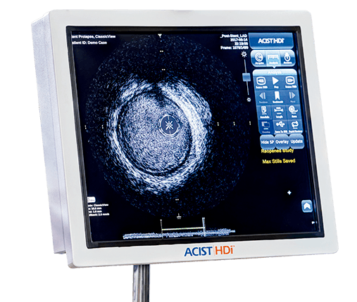 Acist HDI - Scitech